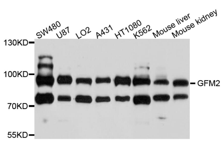 Western Blot - Anti-GFM2 Antibody (A10158) - Antibodies.com