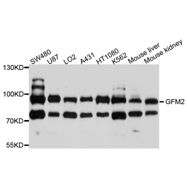 Western Blot - Anti-GFM2 Antibody (A10158) - Antibodies.com