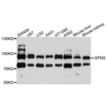 Western Blot - Anti-GFM2 Antibody (A10158) - Antibodies.com