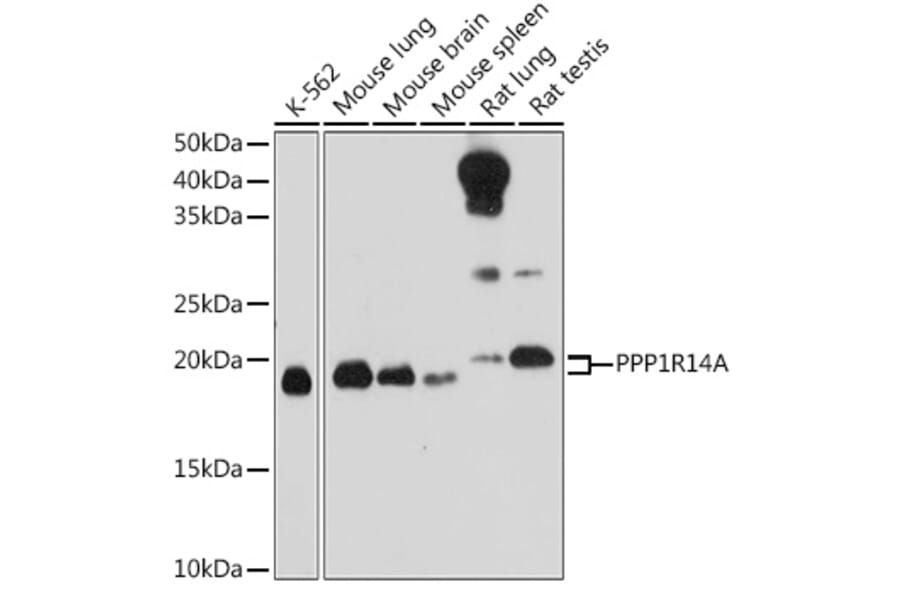 Western Blot - Anti-CPI-17 Antibody (A12816) - Antibodies.com