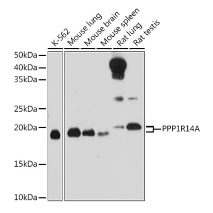 Western Blot - Anti-CPI-17 Antibody (A12816) - Antibodies.com
