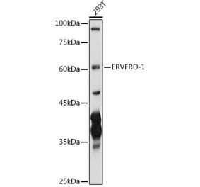 Western Blot - Anti-HERV-FRD Antibody (A12817) - Antibodies.com