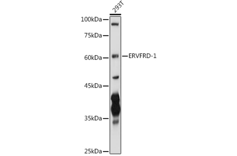 Western Blot - Anti-HERV-FRD Antibody (A12817) - Antibodies.com