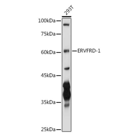 Western Blot - Anti-HERV-FRD Antibody (A12817) - Antibodies.com