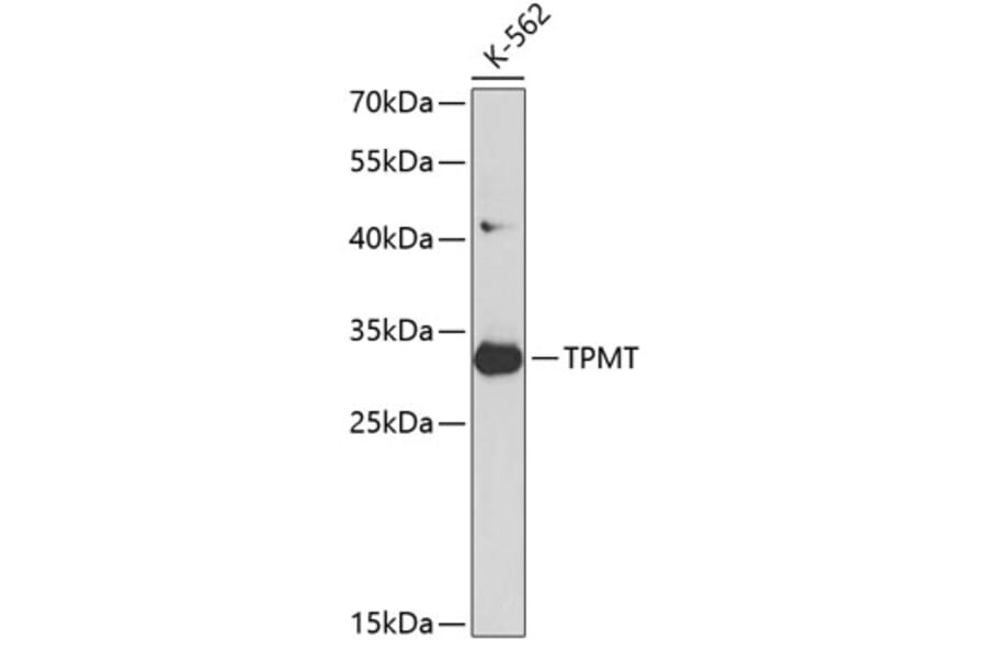 Western Blot - Anti-TPMT Antibody (A12821) - Antibodies.com