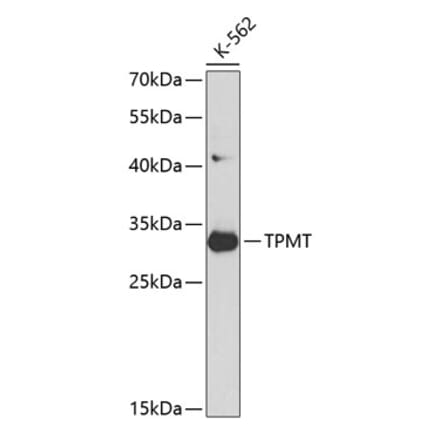 Western Blot - Anti-TPMT Antibody (A12821) - Antibodies.com