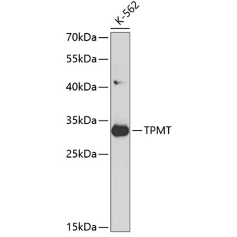 Western Blot - Anti-TPMT Antibody (A12821) - Antibodies.com