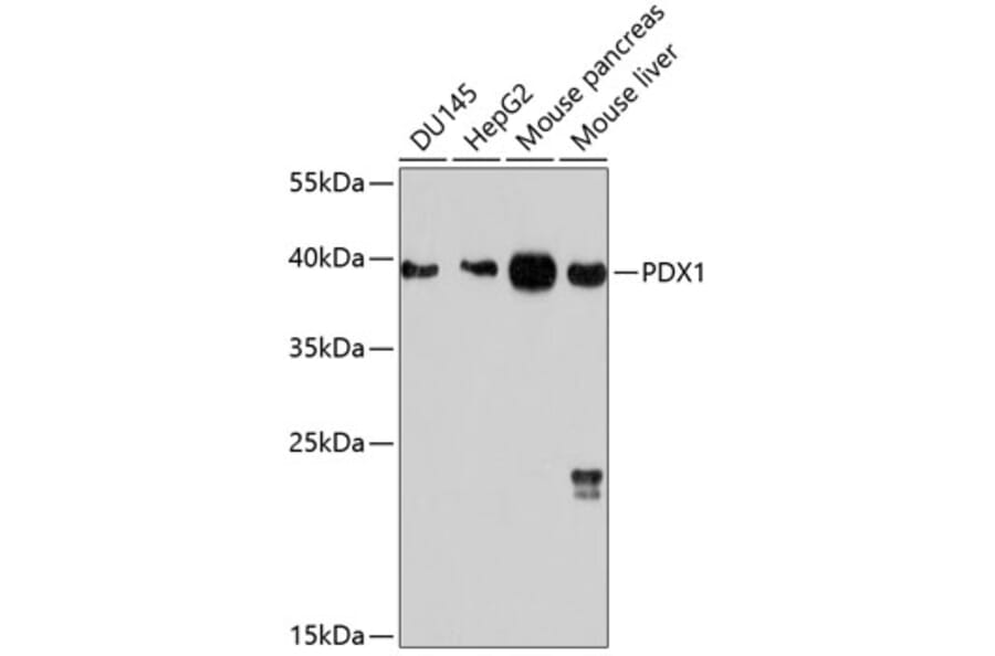 Western Blot - Anti-PDX1 Antibody (A12822) - Antibodies.com