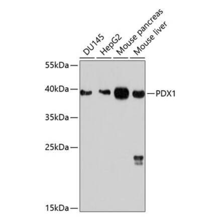 Western Blot - Anti-PDX1 Antibody (A12822) - Antibodies.com