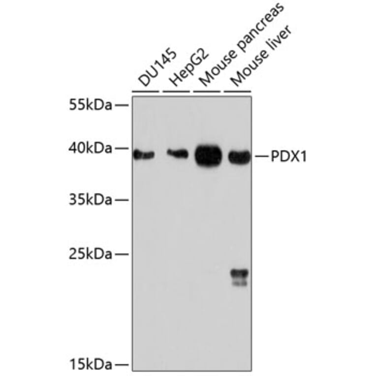 Western Blot - Anti-PDX1 Antibody (A12822) - Antibodies.com