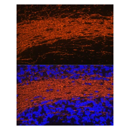 Immunofluorescence - Anti-CNPase Antibody (A12825) - Antibodies.com