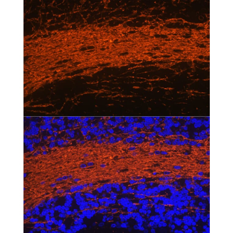 Immunofluorescence - Anti-CNPase Antibody (A12825) - Antibodies.com