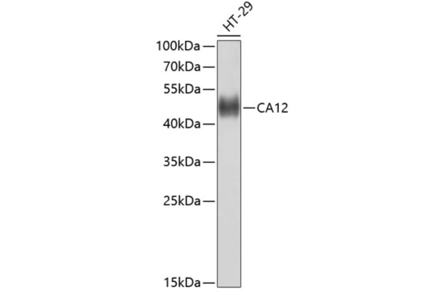 Western Blot - Anti-CA12 Antibody (A10187) - Antibodies.com