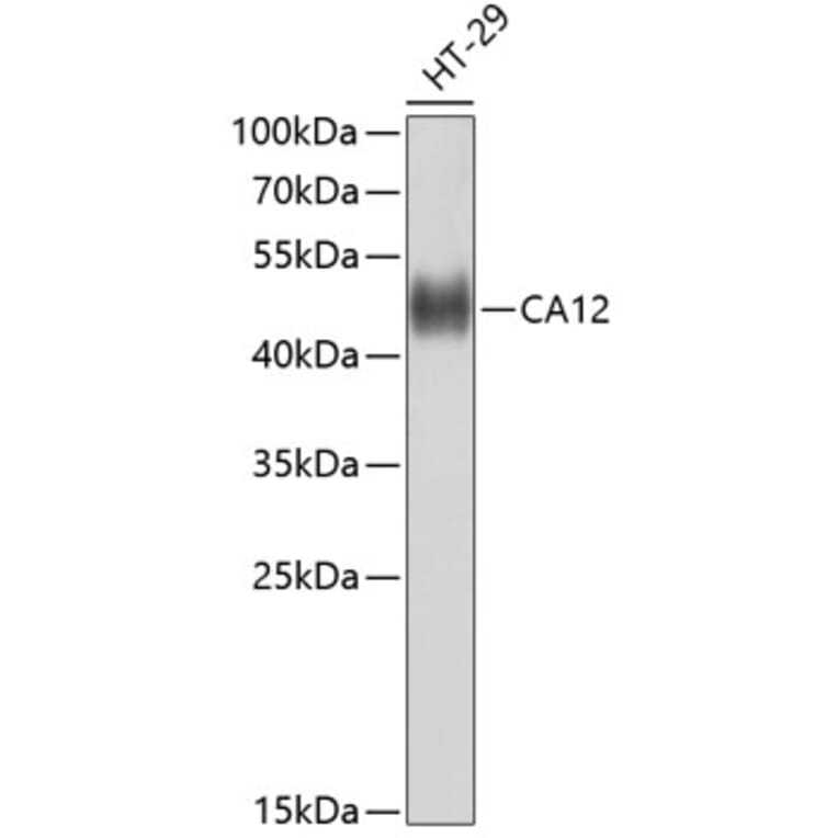 Western Blot - Anti-CA12 Antibody (A10187) - Antibodies.com