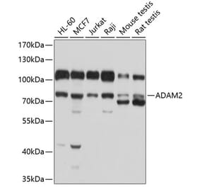 Western Blot - Anti-ADAM2 Antibody (A12831) - Antibodies.com