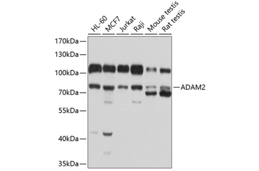 Western Blot - Anti-ADAM2 Antibody (A12831) - Antibodies.com