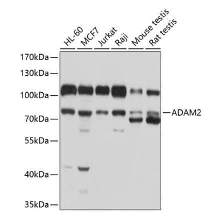 Western Blot - Anti-ADAM2 Antibody (A12831) - Antibodies.com