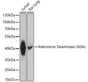 Western Blot - Anti-ADA Antibody (A12832) - Antibodies.com