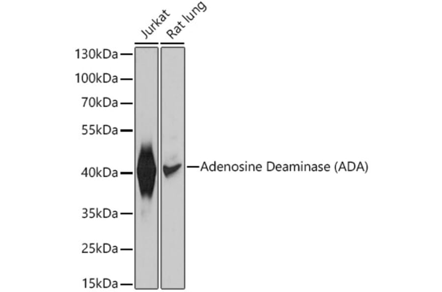 Western Blot - Anti-ADA Antibody (A12832) - Antibodies.com