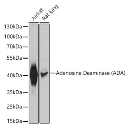 Western Blot - Anti-ADA Antibody (A12832) - Antibodies.com