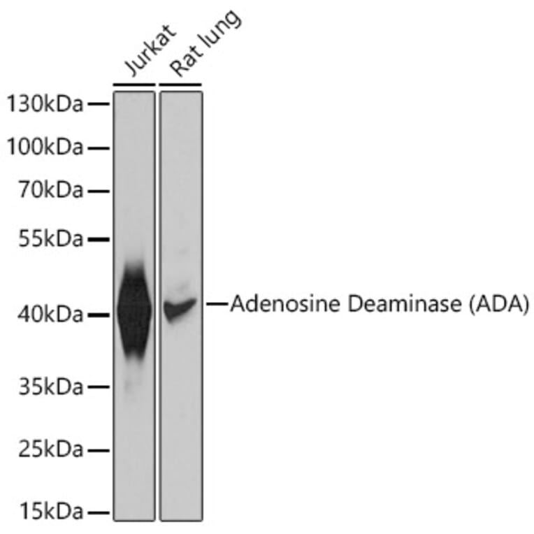 Western Blot - Anti-ADA Antibody (A12832) - Antibodies.com