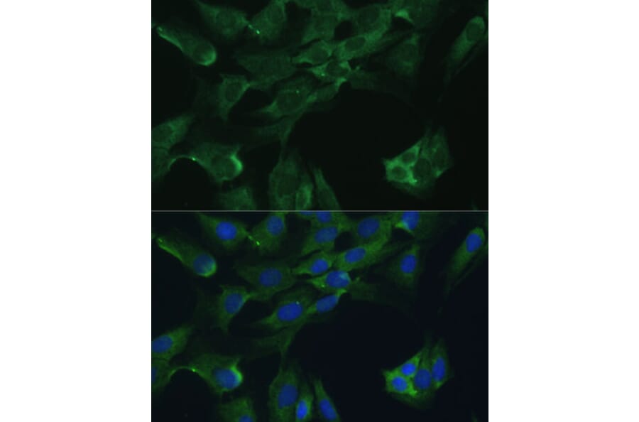 Immunofluorescence - Anti-ADA Antibody (A12832) - Antibodies.com