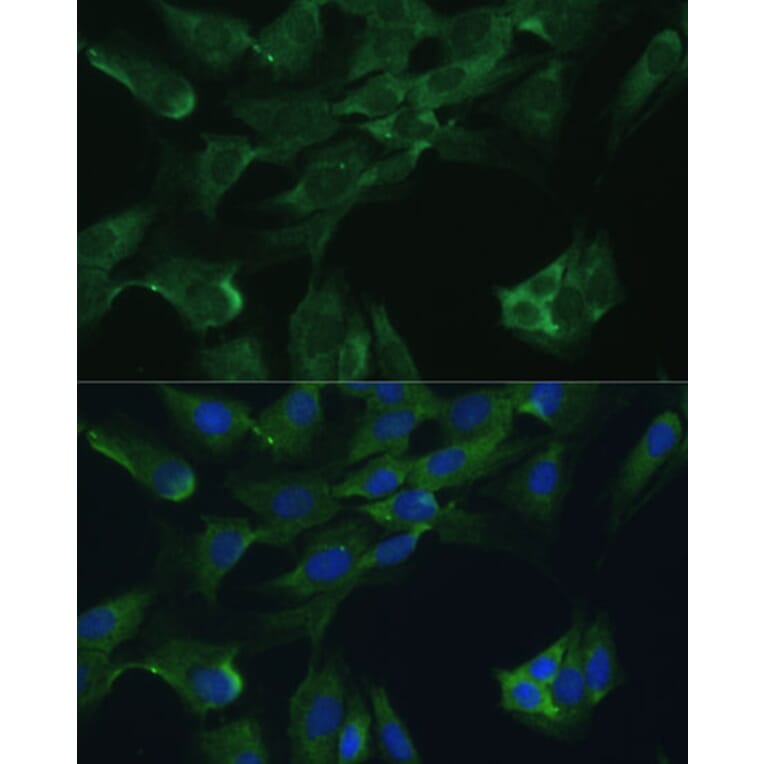 Immunofluorescence - Anti-ADA Antibody (A12832) - Antibodies.com