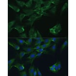 Immunofluorescence - Anti-ADA Antibody (A12832) - Antibodies.com