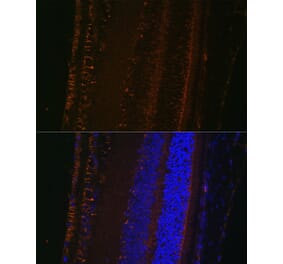 Immunofluorescence - Anti-LOXL1 Antibody (A12833) - Antibodies.com