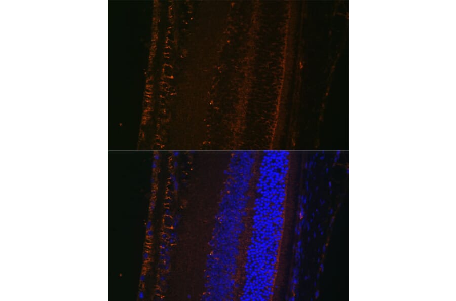 Immunofluorescence - Anti-LOXL1 Antibody (A12833) - Antibodies.com
