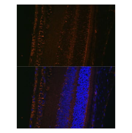 Immunofluorescence - Anti-LOXL1 Antibody (A12833) - Antibodies.com