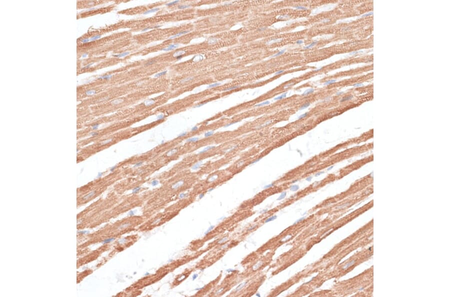 Immunohistochemistry - Anti-KIF4A/KIF4 Antibody (A12834) - Antibodies.com