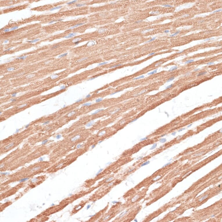 Immunohistochemistry - Anti-KIF4A/KIF4 Antibody (A12834) - Antibodies.com
