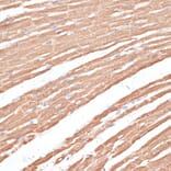 Immunohistochemistry - Anti-KIF4A/KIF4 Antibody (A12834) - Antibodies.com