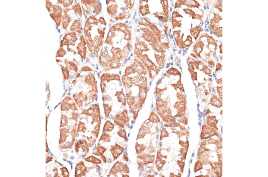 Immunohistochemistry - Anti-KIF4A/KIF4 Antibody (A12834) - Antibodies.com