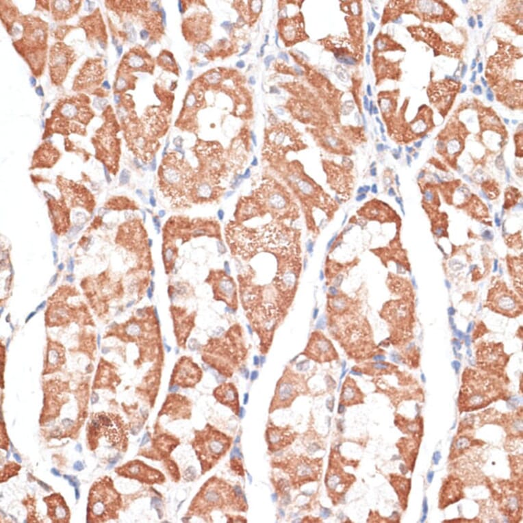 Immunohistochemistry - Anti-KIF4A/KIF4 Antibody (A12834) - Antibodies.com
