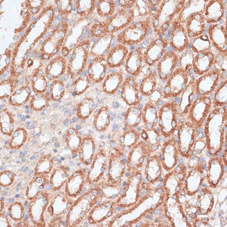 Immunohistochemistry - Anti-KIF4A/KIF4 Antibody (A12834) - Antibodies.com