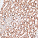 Immunohistochemistry - Anti-KIF4A/KIF4 Antibody (A12834) - Antibodies.com