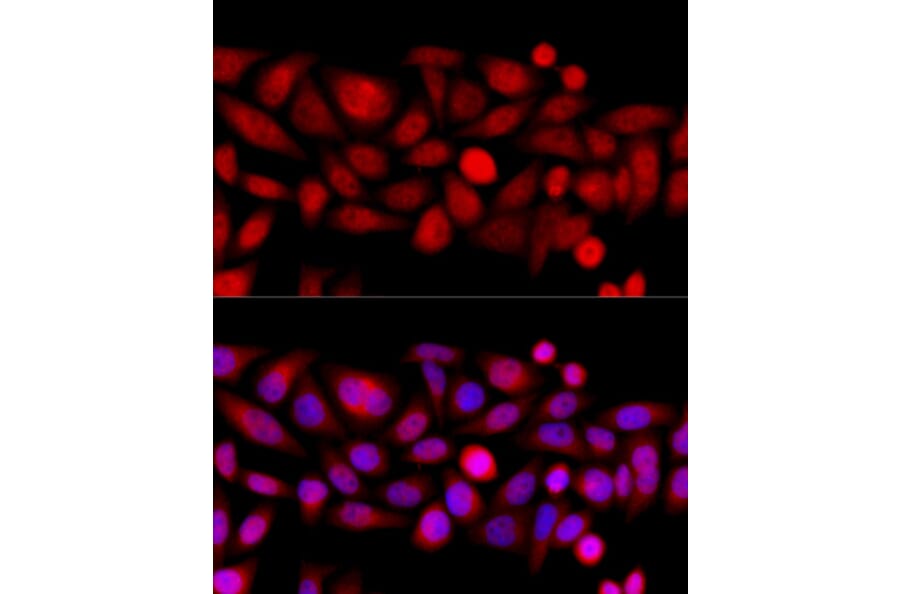 Immunofluorescence - Anti-KIF4A/KIF4 Antibody (A12834) - Antibodies.com