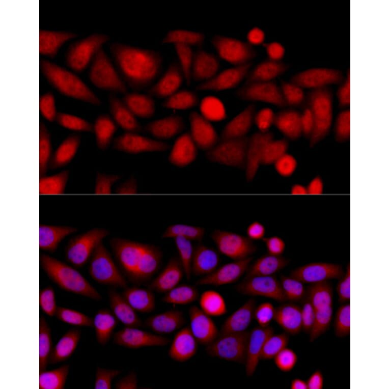 Immunofluorescence - Anti-KIF4A/KIF4 Antibody (A12834) - Antibodies.com