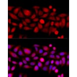 Immunofluorescence - Anti-KIF4A/KIF4 Antibody (A12834) - Antibodies.com