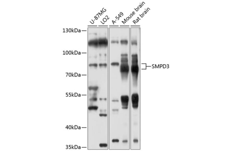 Western Blot - Anti-NSMase2 Antibody (A12835) - Antibodies.com