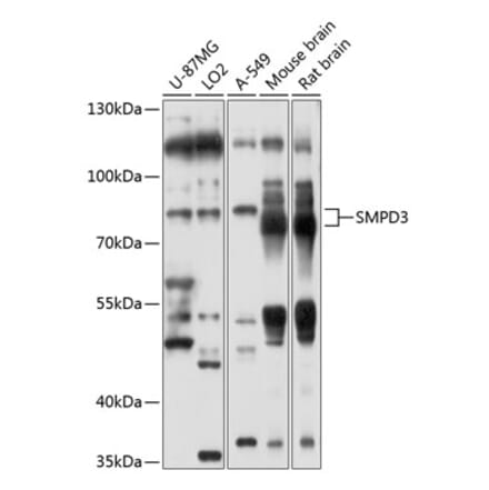 Western Blot - Anti-NSMase2 Antibody (A12835) - Antibodies.com