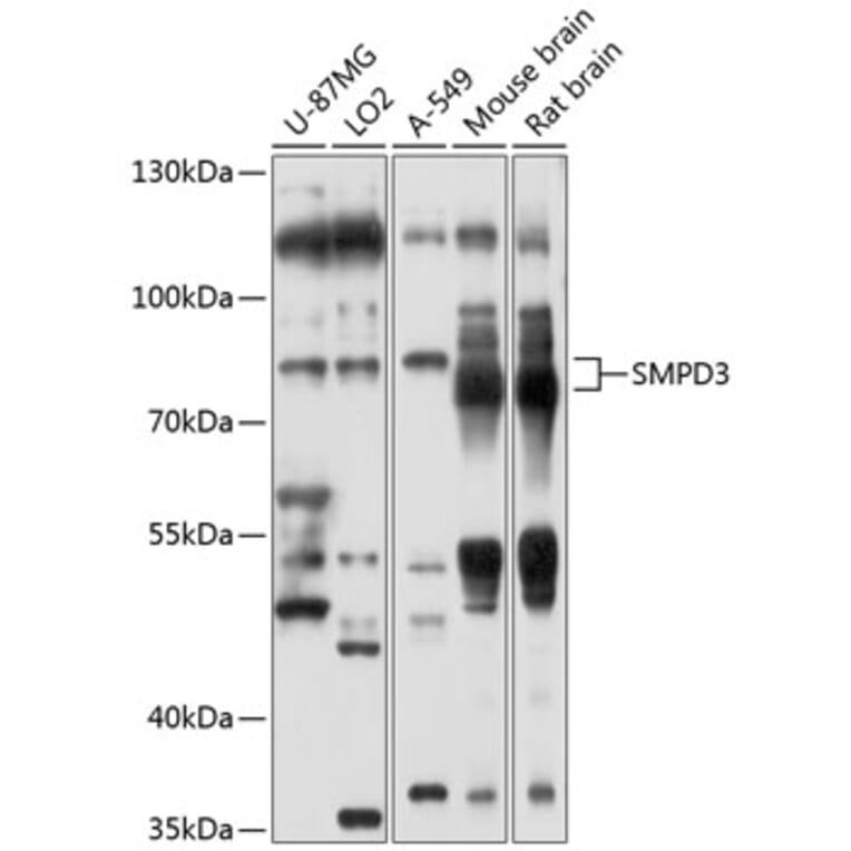Western Blot - Anti-NSMase2 Antibody (A12835) - Antibodies.com