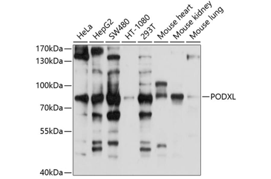 Western Blot - Anti-PODXL Antibody (A12836) - Antibodies.com
