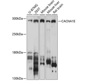 Western Blot - Anti-CACNA1E Antibody (A12837) - Antibodies.com
