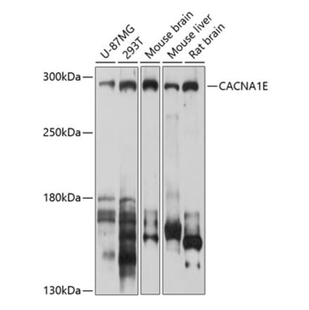 Western Blot - Anti-CACNA1E Antibody (A12837) - Antibodies.com