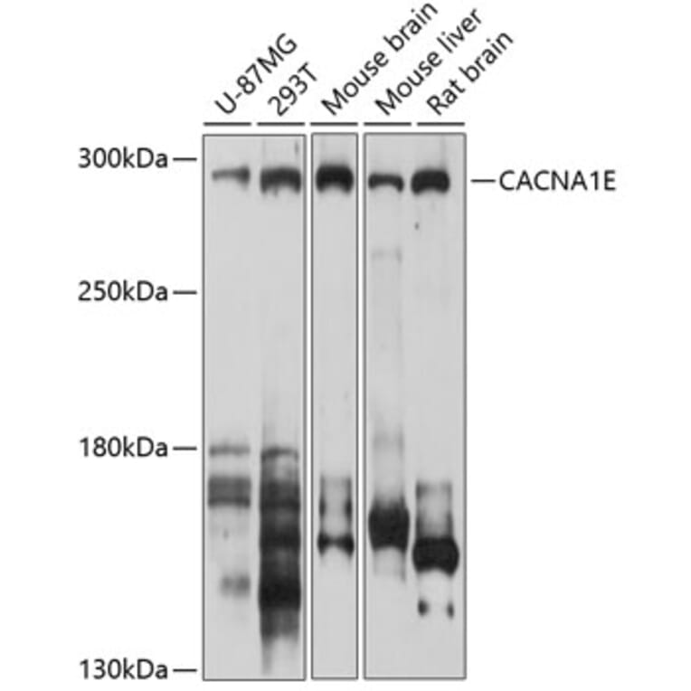 Western Blot - Anti-CACNA1E Antibody (A12837) - Antibodies.com