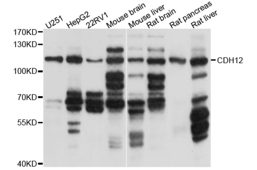 Western Blot - Anti-CDH12 Antibody (A10206) - Antibodies.com