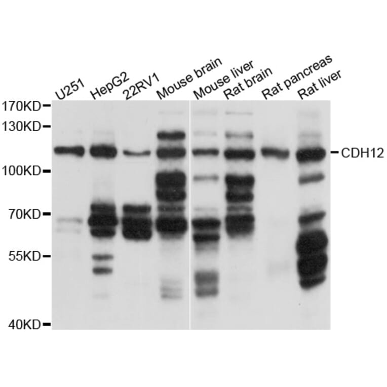 Western Blot - Anti-CDH12 Antibody (A10206) - Antibodies.com
